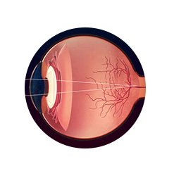 Optometry/Opthalmology